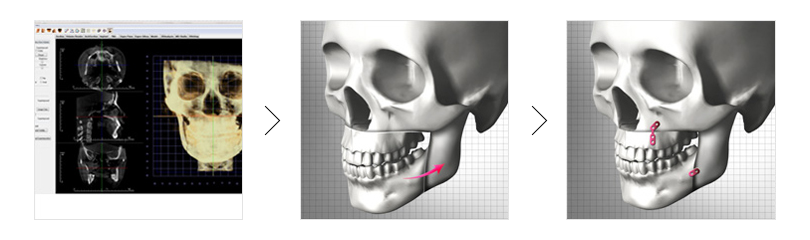 ¾ç¾Ç¼ö¼ú ¼ö¼úÁ¤º¸